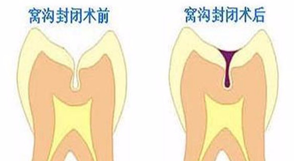 10万的病，30元就能解决，今天你赚到了吗？