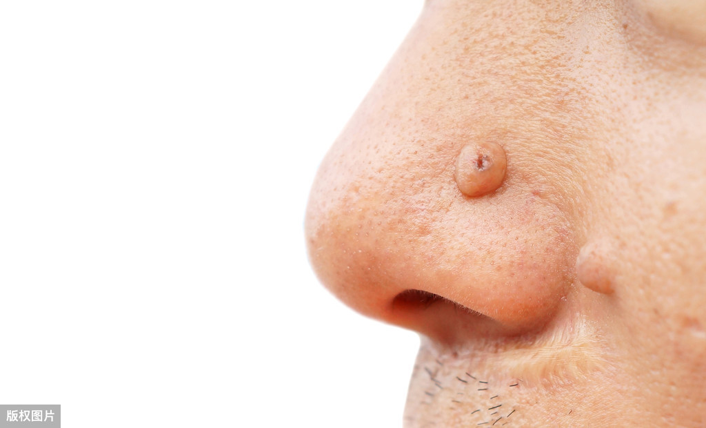 身体有病，鼻子先知：难怪鼻子在中医里有“面王”之称