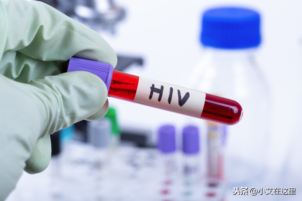 做艾滋病病毒抗体检测需要多长时间？