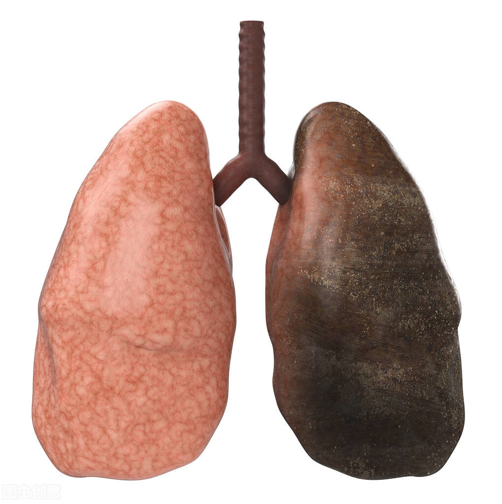 抽烟10年的肺图片