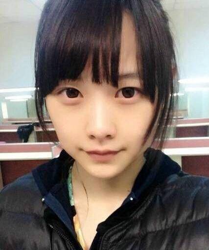 snh48唐安琪(烧伤的唐安琪终于出来表态了,她说是自己造成的)
