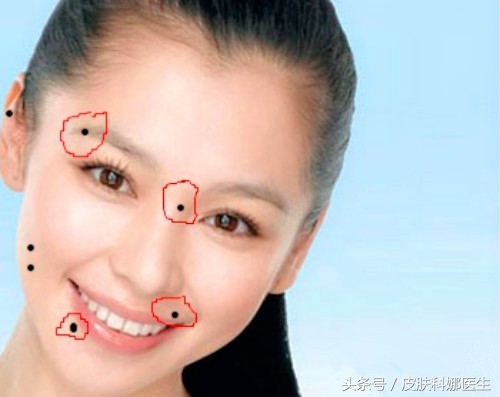 痦子的位置与命运图 痦子的位置与命运图解大全_达一风水网