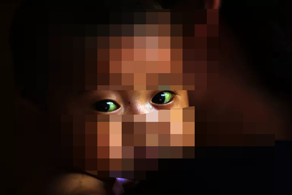 长春女婴胆道闭锁一双“绿眼睛”，父亲捐肝救女在沪成功移植