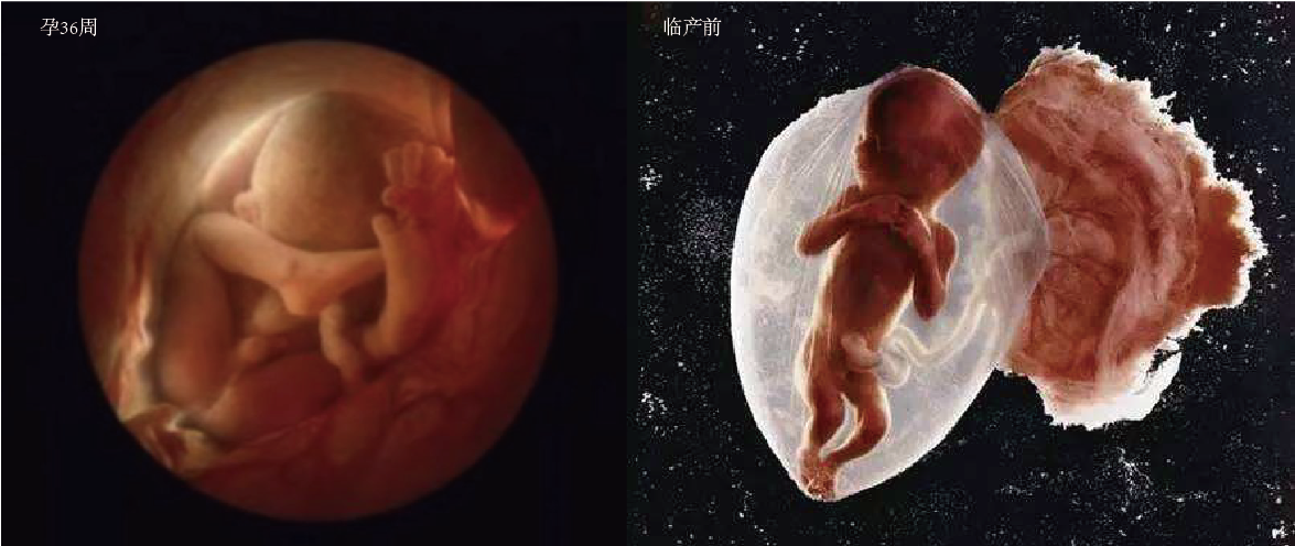 一个婴儿诞生的全过程，10张高清图带你了解，感叹新生命的力量