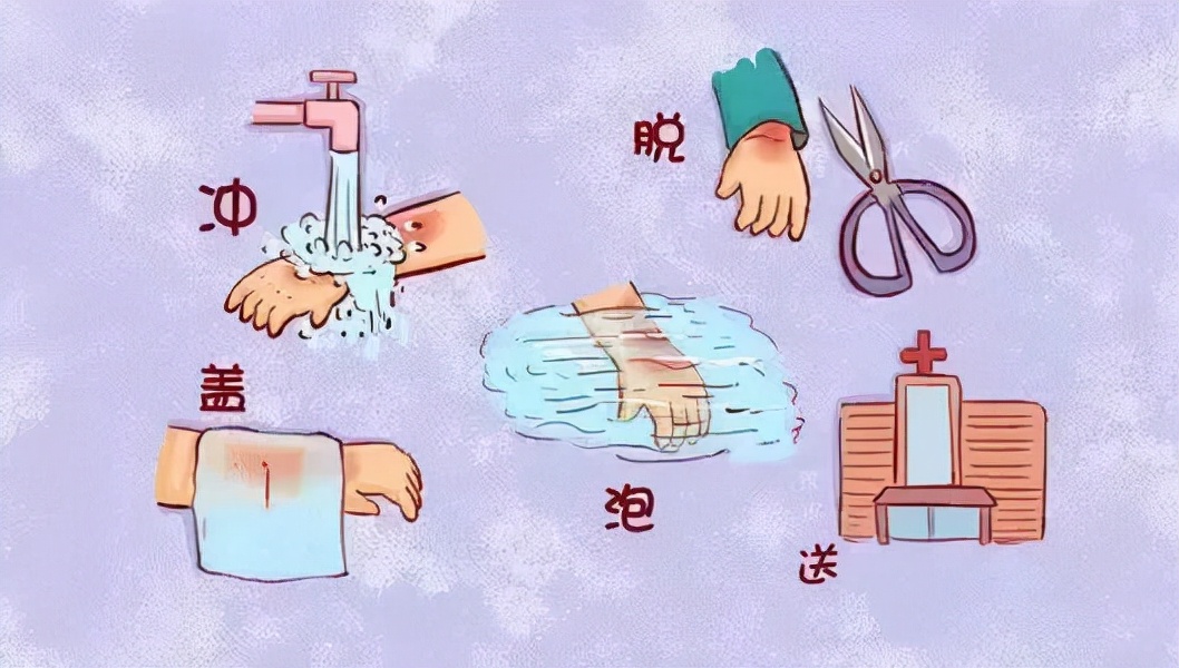 酱油还是烫伤膏?