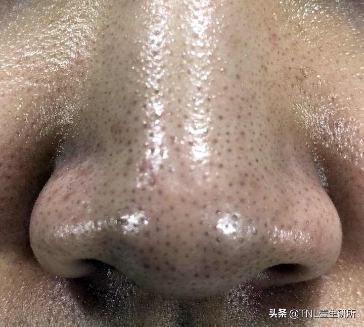 如何区分皂基洗面奶和氨基酸洗面奶？哪种更好用？