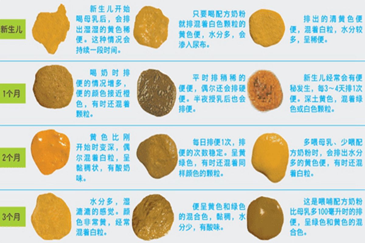 母乳宝宝大便正常图片(宝宝的便便)