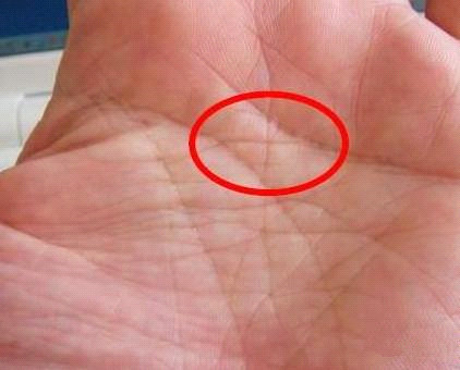 通天纹额头图片 额头通天纹是什么样子-起航号