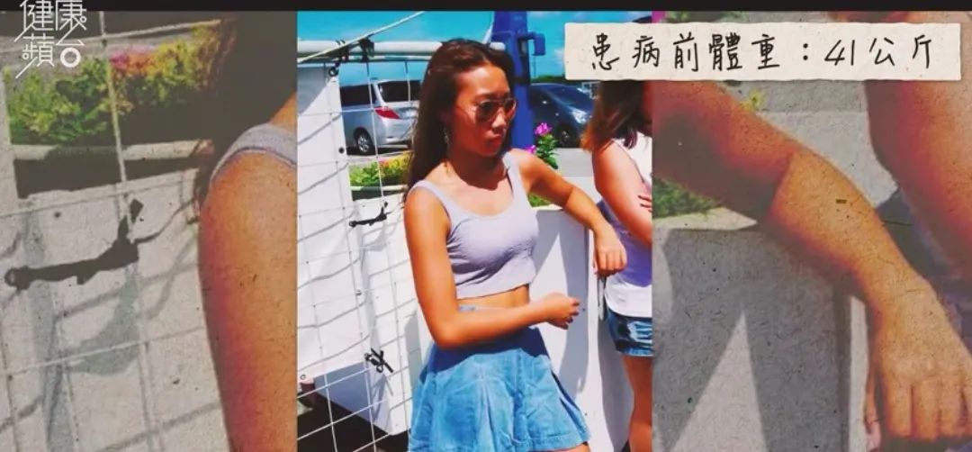 00后英国留学患病暴肥19kg，停止减肥才是出路？