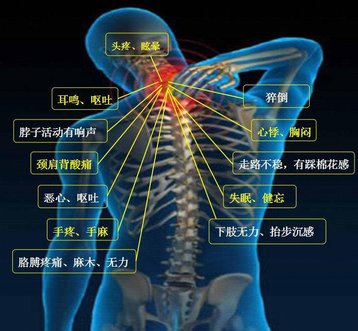 6岁孩子患颈椎病！颈椎病有哪些症状？3个自测实验可以试试