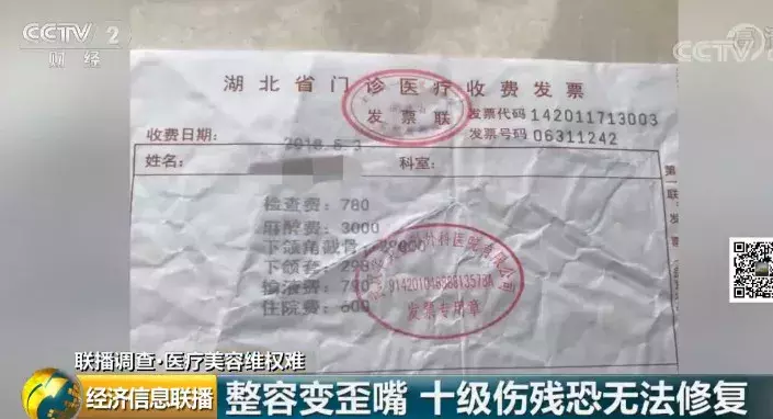 毁一生!25岁姑娘整容致十级伤残,嘴歪成这样……医院只赔5000元