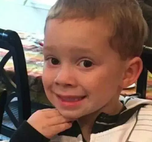 扁桃体也会长结石？！这是一条有味道的科普