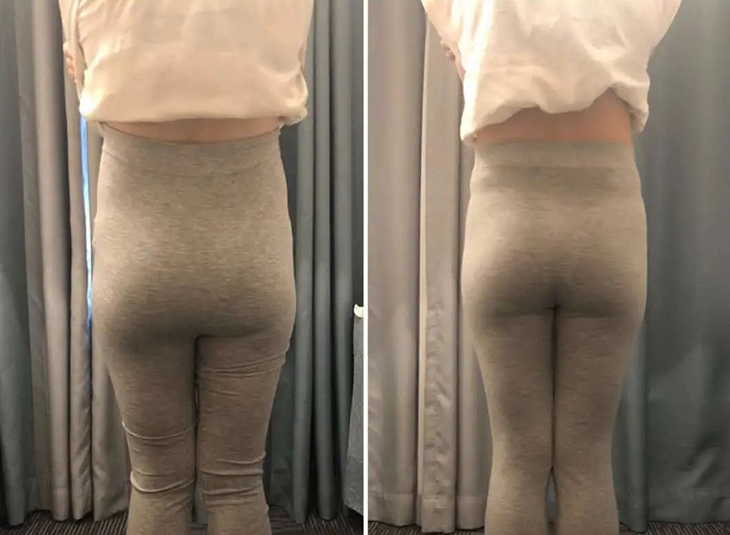 女人有没有生过孩子，从身体的这三个部位就能看出来，区别很明显