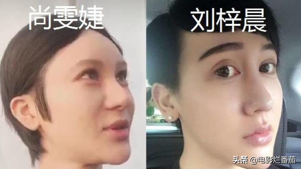 8位女星的整容“塌房路”：有人葬送事业，有人毁容，张檬可惜了