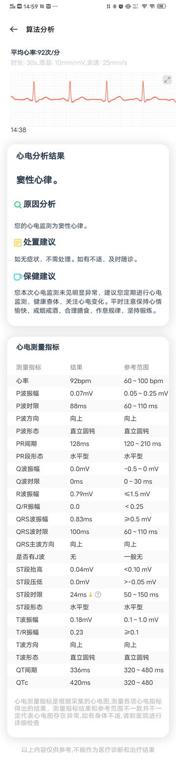 OPPO Watch ECG 版评测：心电检测，专业的