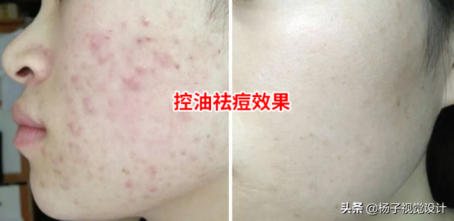 海藻籽面膜的功效與作用機理，什么品牌的海藻面膜好？（配圖）