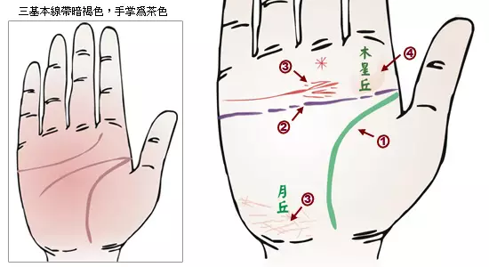 掌纹诊病：可以诊断肝癌、糖尿病、高血压、妇科病、脑溢血