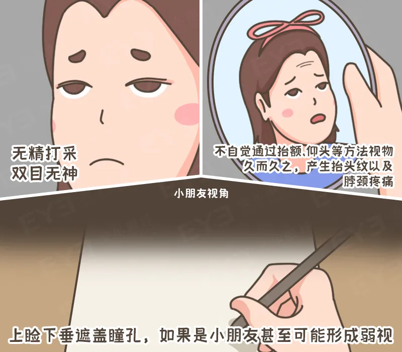 眼皮没力气，不是“睡不醒”，而是“上睑下垂”这种病