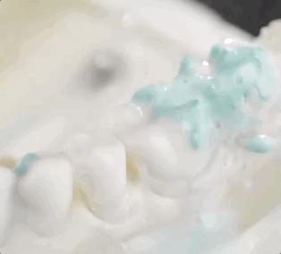 牙科拜拜,用它在家也能洗牙,每次不到2毛
