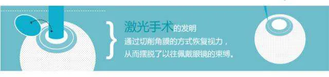 30年前做近视激光手术的人，现在后悔了吗？看完心里有数了