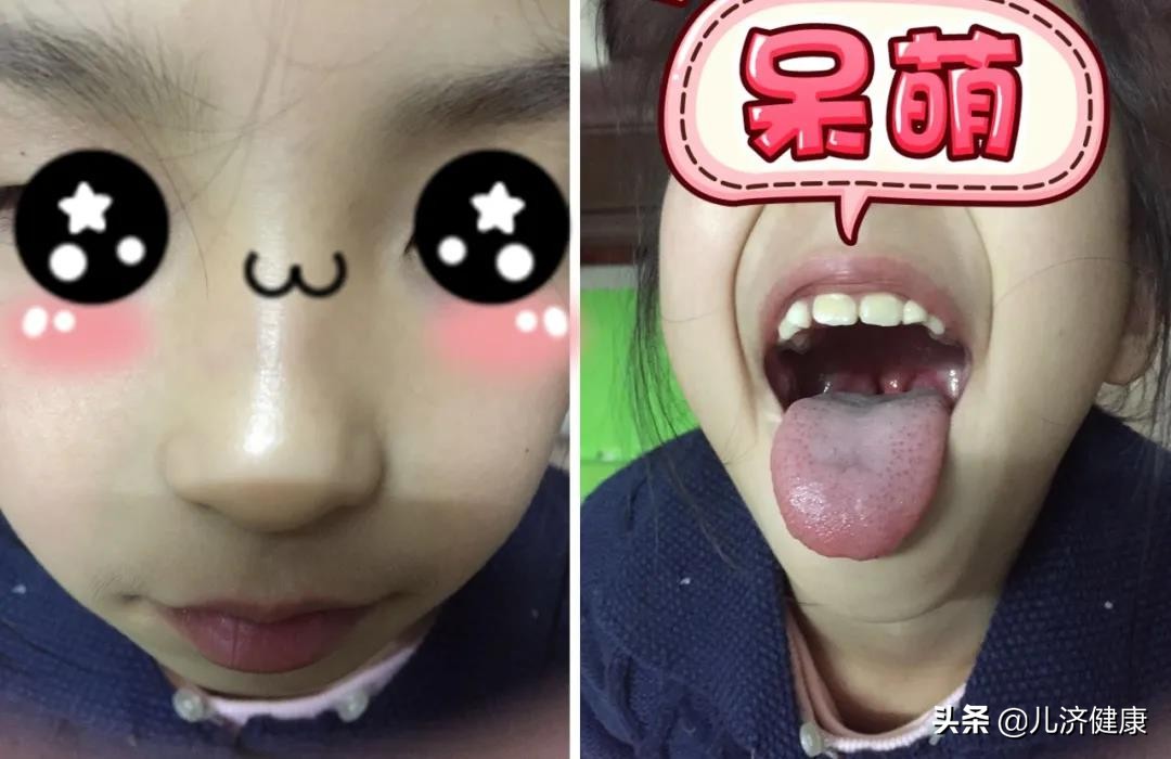 许尤佳教授：儿童脾胃虚寒调理指南与案例