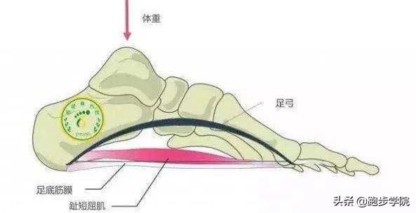 足底筋膜炎能彻底好么(足底筋膜炎的预防、治疗和恢复，看这篇就够了)