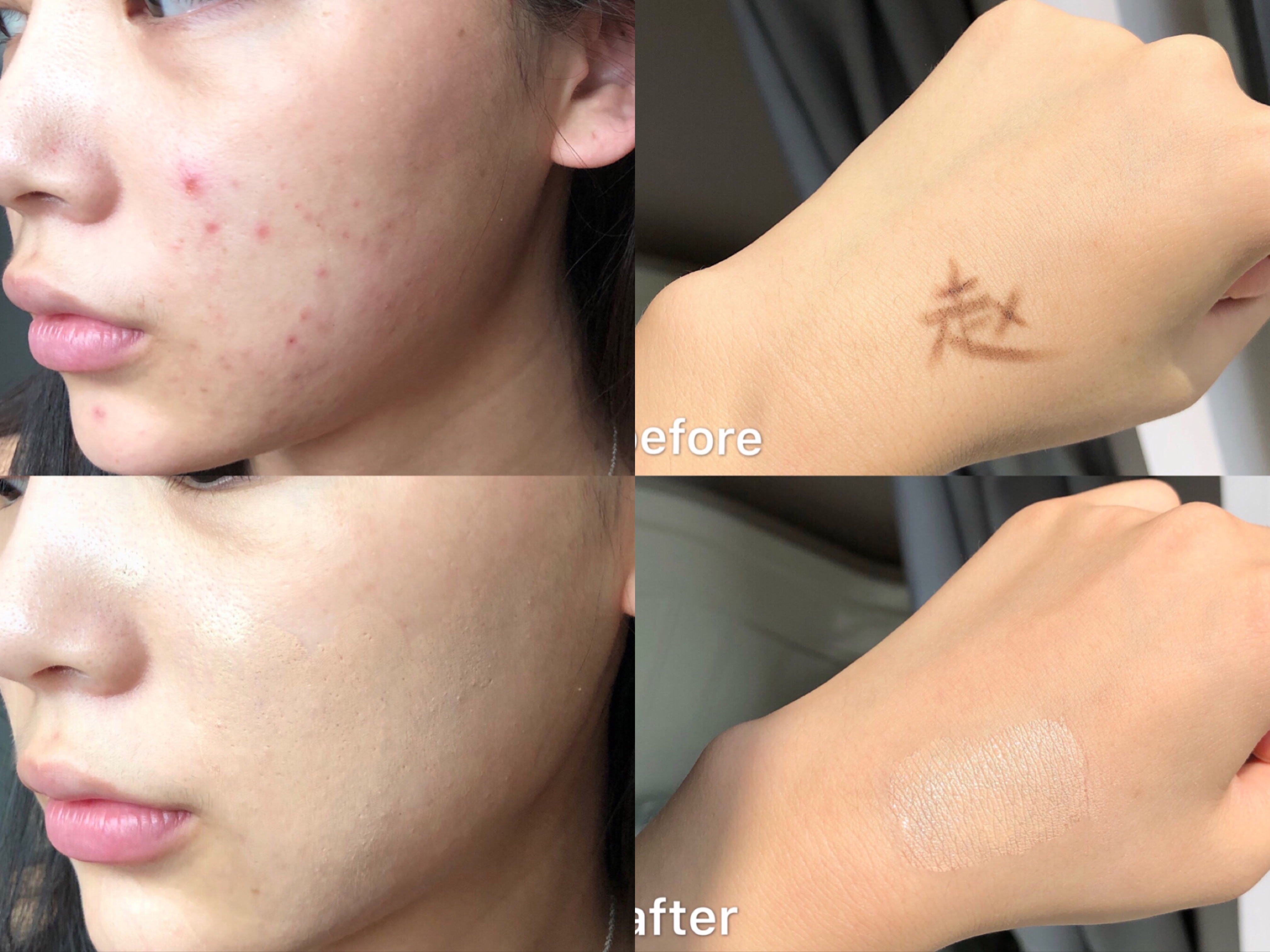 遮瑕膏排行榜前十名公认好用的遮瑕膏排行榜前十名推荐