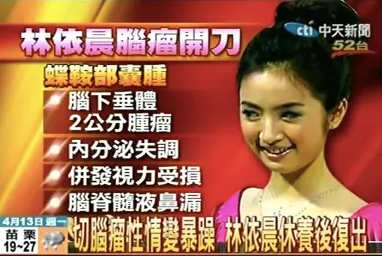 16岁赚钱养家22岁立遗书，为怀孕生吃田鸡，林依晨的苦远不止于此