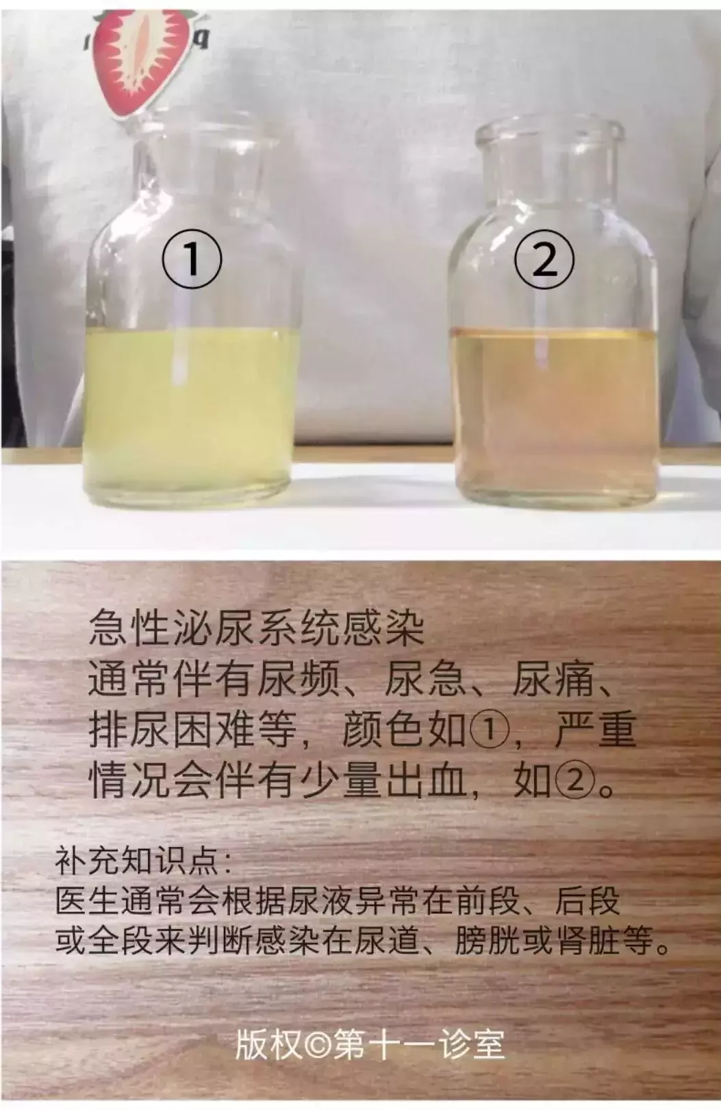 故事的尿性寓意 _飞翔号