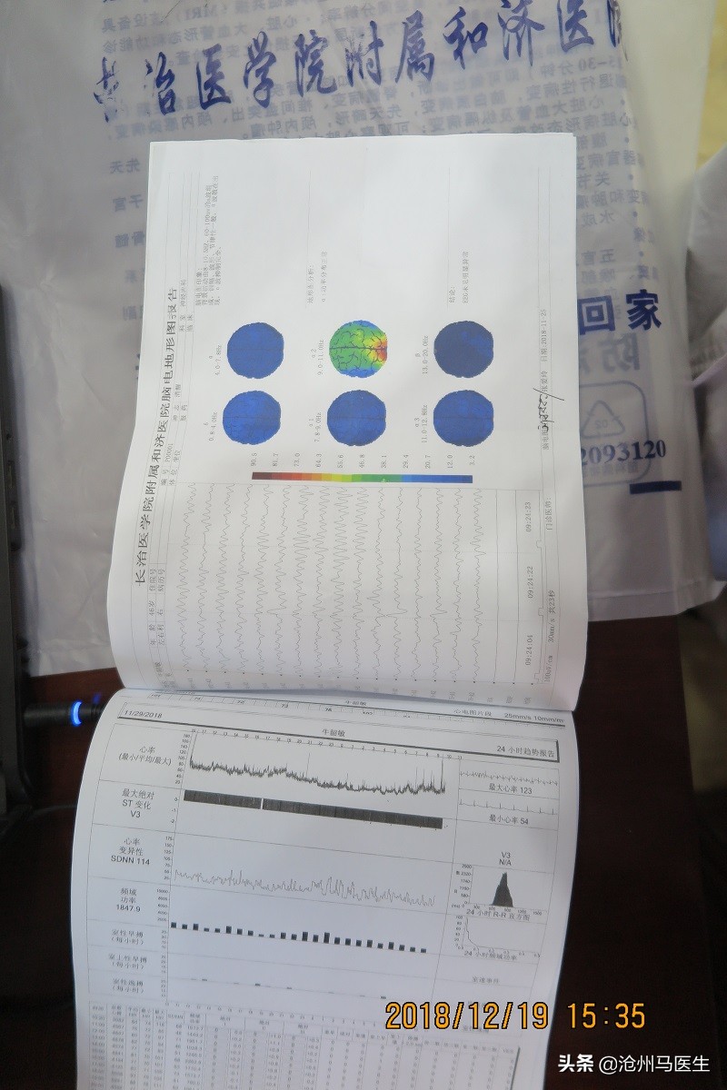 天旋地转，眩晕恶心、呕吐、心慌的中医治疗病例报告分析
