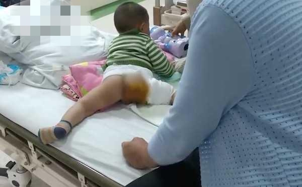 每年2600人烫伤，孩子烫伤后5步紧急处理是关键，建议收藏