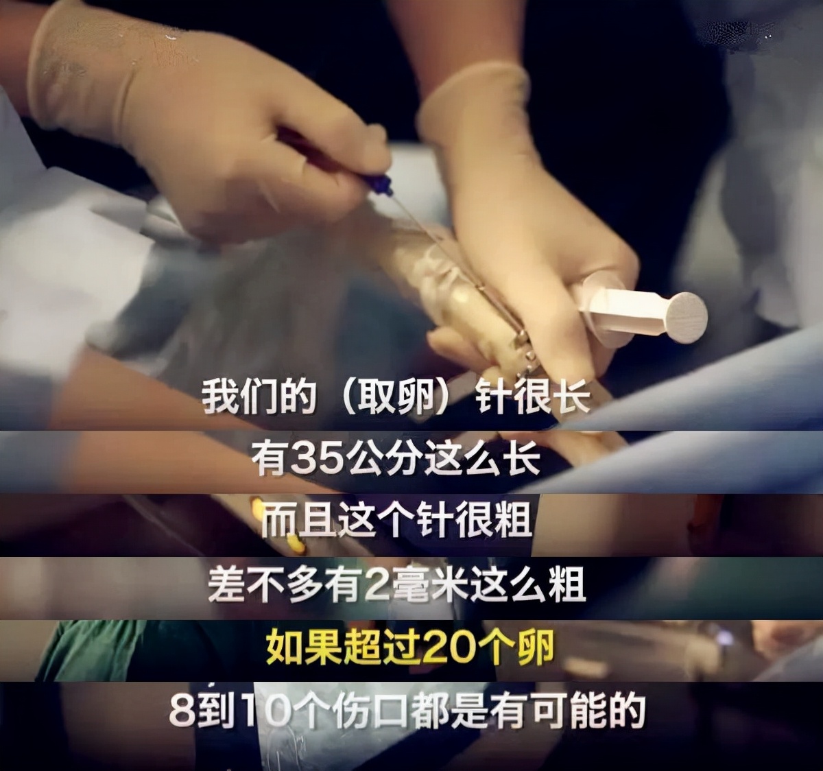 高校女卫生间出现代孕、捐卵广告，背后是女大学生对欲望的不节制