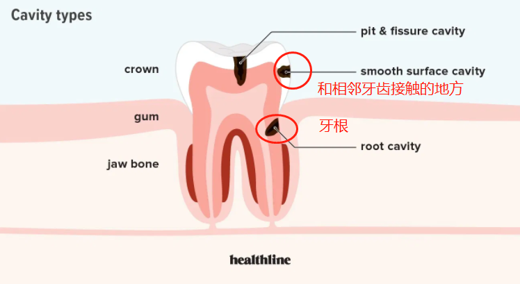 好臭！很多宝宝的牙缝，从出生就没洗过