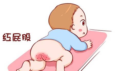 婴儿下面红红的怎么办(新生儿有) - 乐宝宝贝
