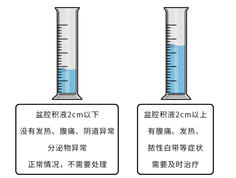 女性须知：体检发现5种妇科病，不要乱治！花了冤枉钱还伤身体