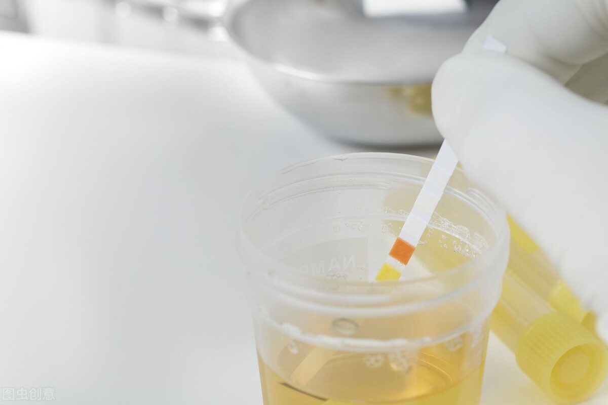 想要知道有没有尿毒症，要怎么做？这4种检查方法少不了