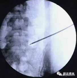 微创骨科医疗器械初步分析