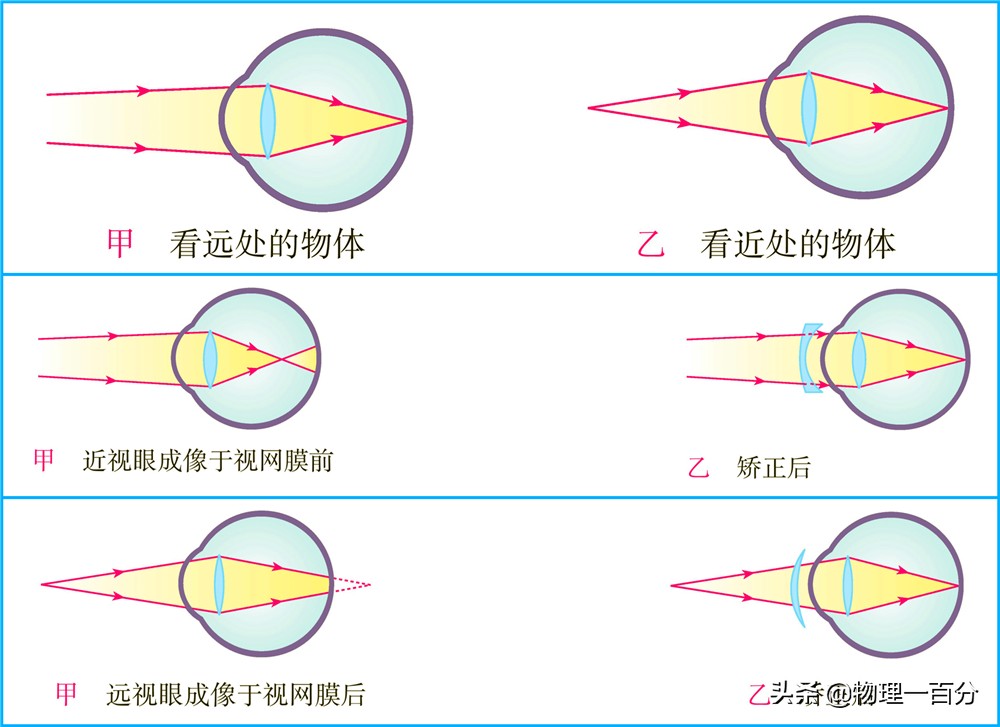 中考物理一轮复习知识方法归纳：近视眼和远视眼的成因与矫正