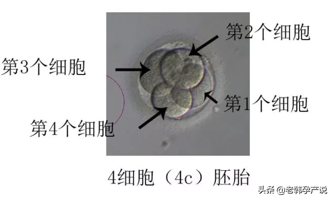 试管婴儿成功率高的医生，这样评估胚胎等级