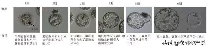 试管婴儿成功率高的医生，这样评估胚胎等级