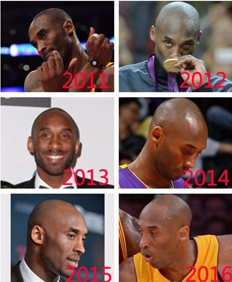 他的脱发史是怎样的(NBA球星脱发心酸路：马努是被邓肯摸秃？科比从当年爆炸头到光头)