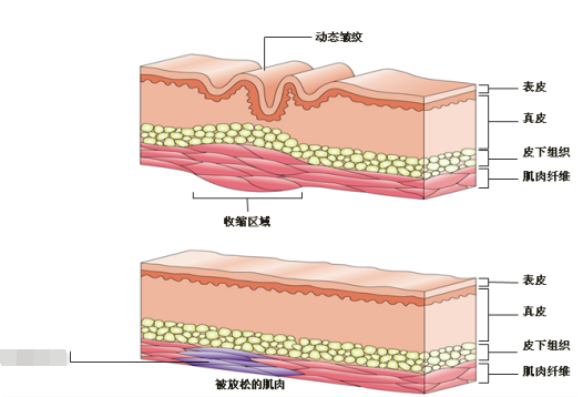 快速消除眉间纹 男女通用的5个妙招