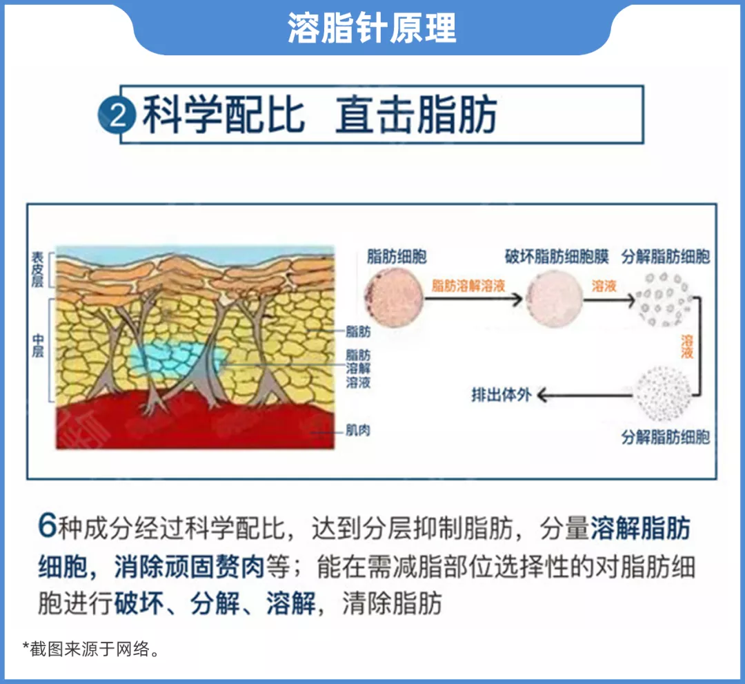 美白针、溶脂针是国家违禁项目，注意避坑