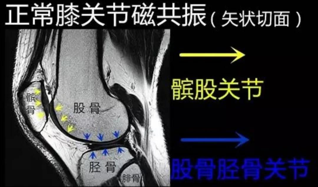 腰腿疼，磁共振比CT照得最清楚？医生辟谣，有钱选不对，也白搭