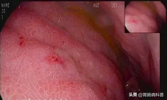 年过40,这个检查必须得做