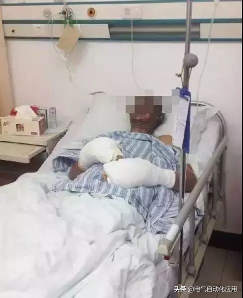 什么是静电?静电到底有多恐怖?最严重可致人死亡，还不来看看！