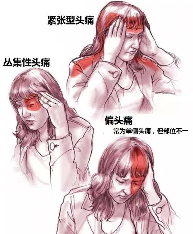 从解剖结构来看这个"脑瓜子疼"