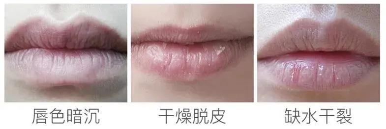 号称“唇纹小熨斗”，德国凡士林润唇膏，一抹死皮干纹都不见