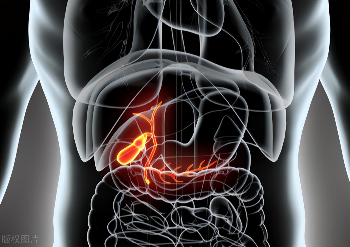 患上胆结石！切胆还是保胆？微创保胆术后注意全在这里