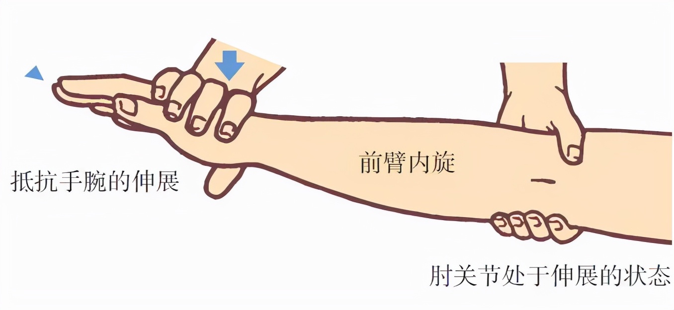 網(wǎng)球肘的癥狀如何治療（有一種胳膊痛叫“網(wǎng)球肘”！送上治療全攻略①）